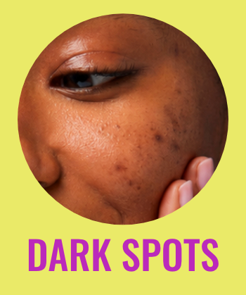 Dark spots