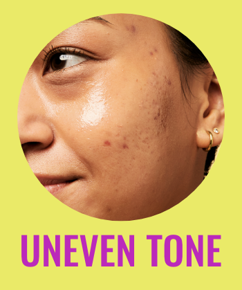 Uneven tone