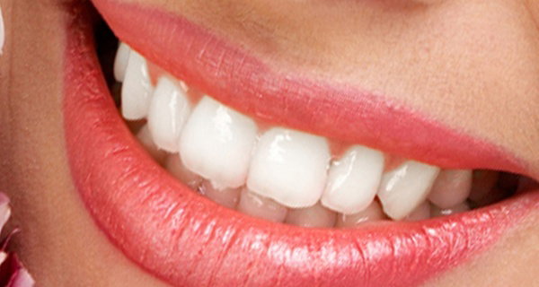 Blanqueamiento LED+limpieza bucal