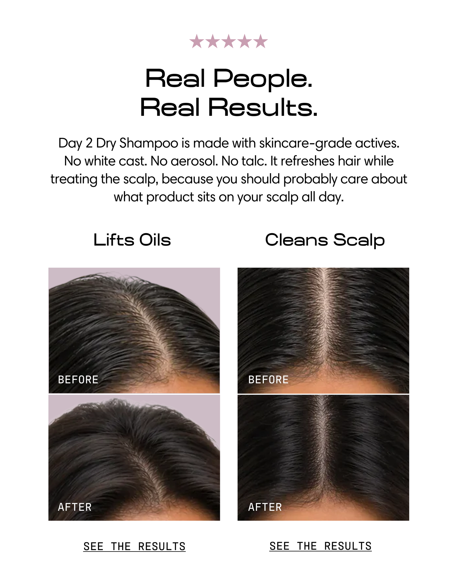Real people. Real results. Day 2 Dry Shampoo is made with skincare-grade actives — no white cast, no aerosol, no talc. It refreshes hair while treating the scalp, because you should probably care about what sits on your scalp all day. Before-and-after photos show lifted oils and a cleaner scalp. See the results.