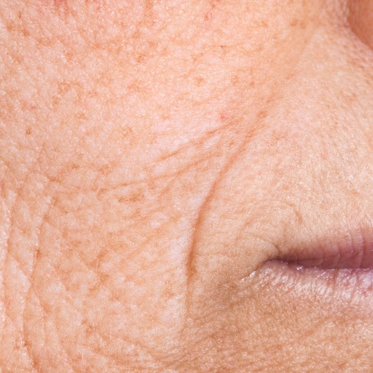 Fine Lines
