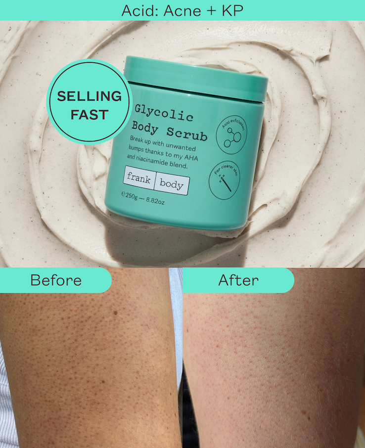 Glycolic Body Scrub