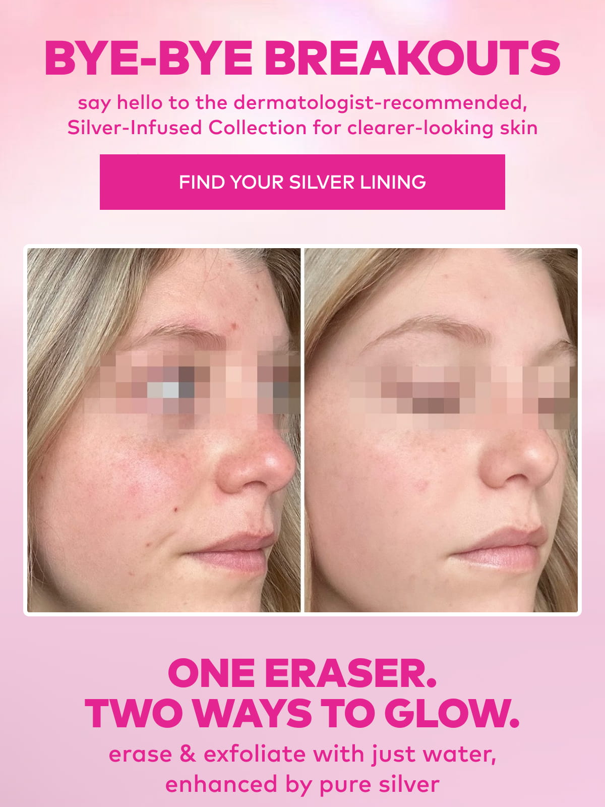 Bye-Bye Breakouts