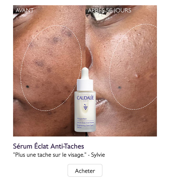 Sérum Éclat Anti-Taches