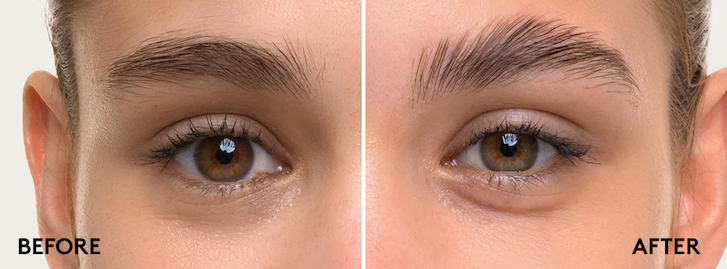 before and after