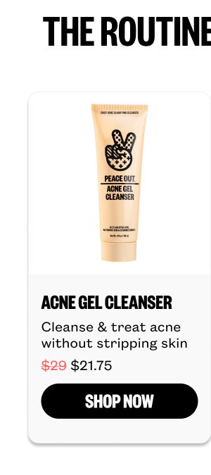 Acne Gel Cleanser for 21.75