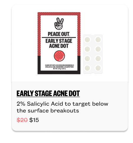 Early Stage Acne Dots for $15