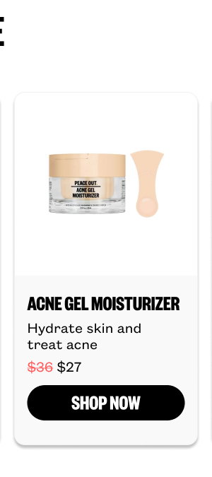 Acne Gel Moisturizer for $27