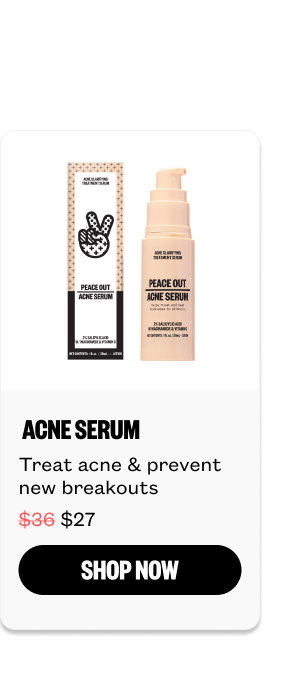 Acne Serum for $27