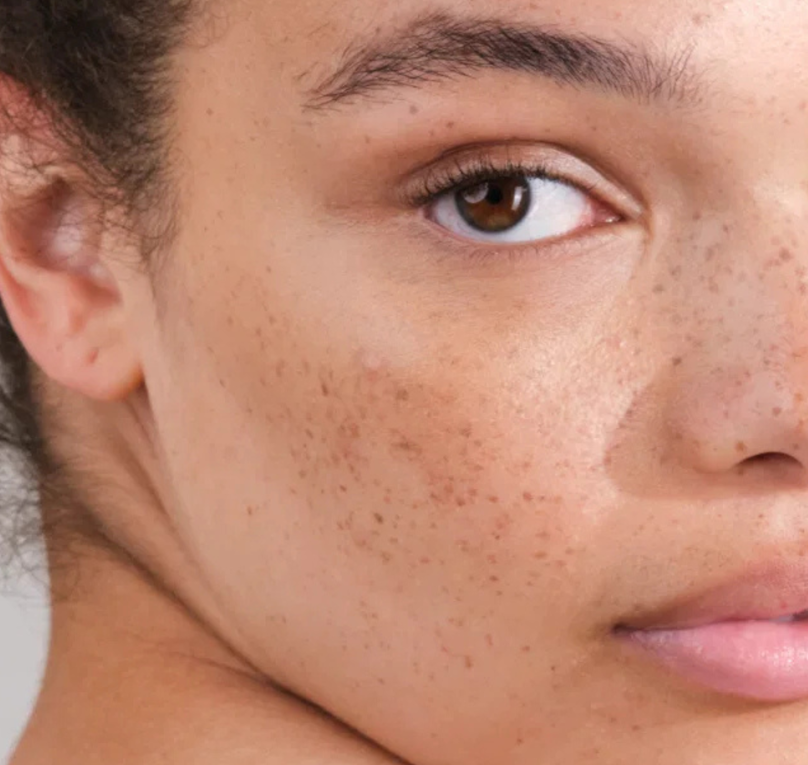 How to manage pigmentation