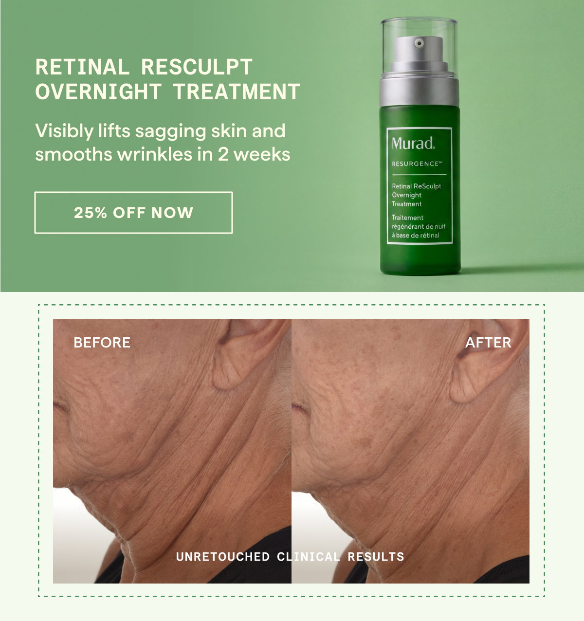 Retinal ReSculpt™ Overnight Treatment