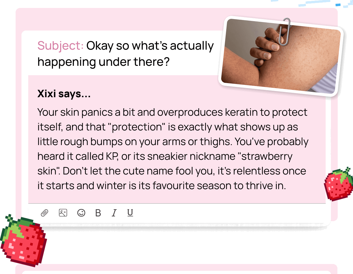 Email-style card explaining keratin buildup causing rough bumps, Kp and strawberry skin in winter