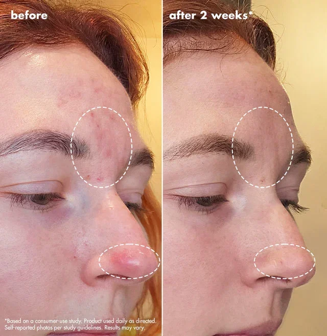 before after
