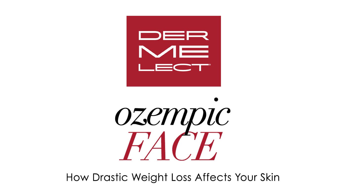 Ozempic Face