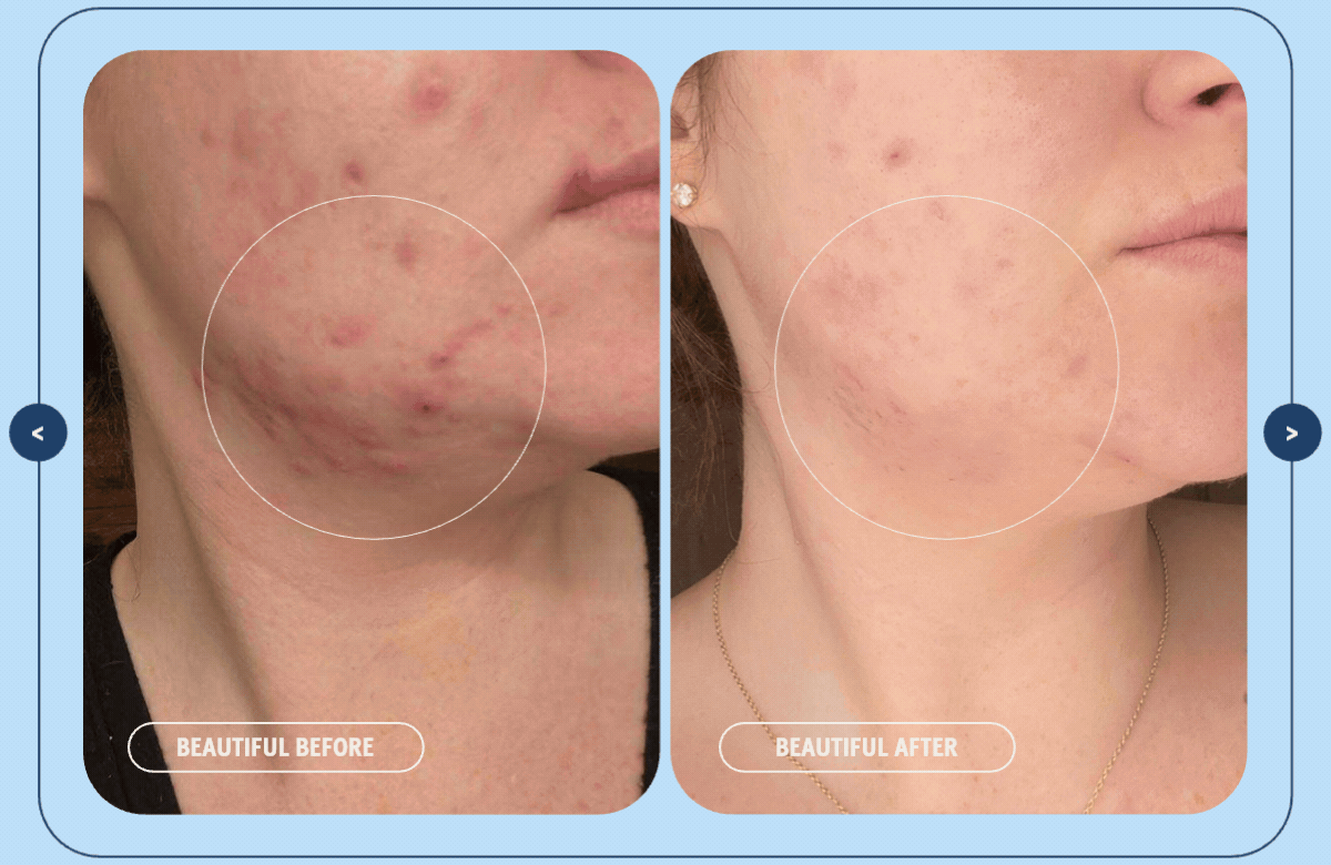 Because Healthy Skin Is Personal