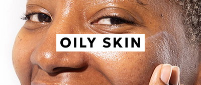 Oily Skin