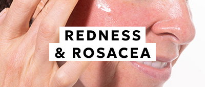 Redness & Rosacea