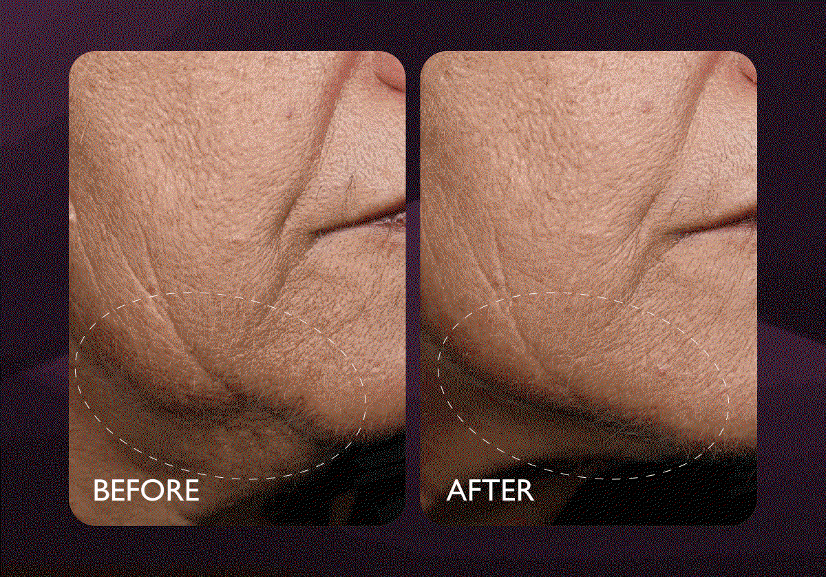 Before & After