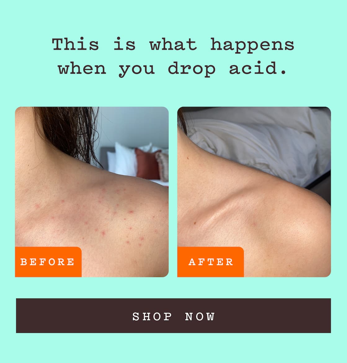 Glycolic Body Scrub