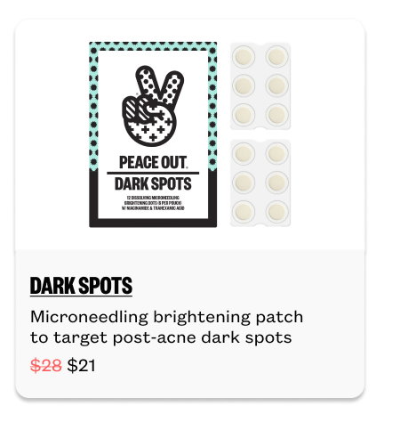 Acne Day & Night Duo for $15