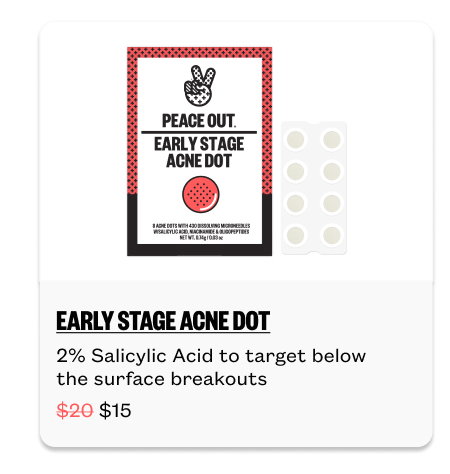 Early Stage Acne Dots for $15
