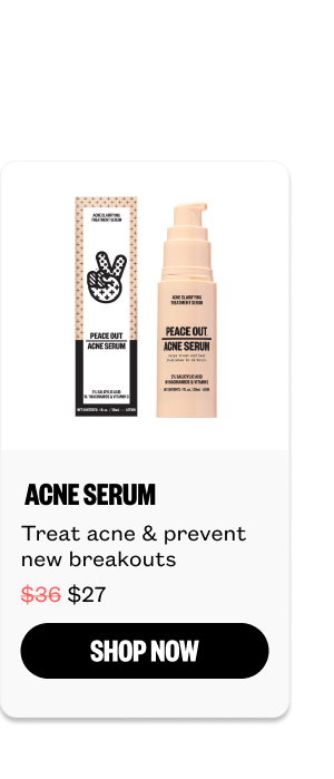 Acne Serum for $27