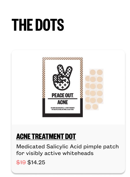 Acne Treatment Dots for $14.25