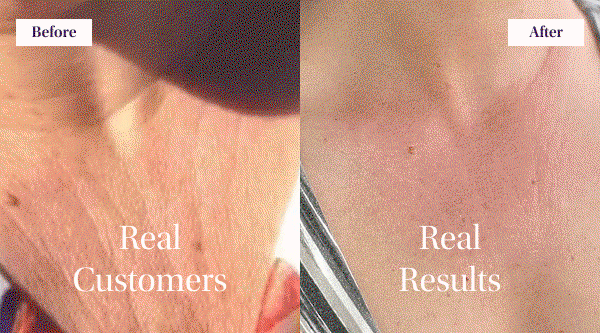 Shop 40% Off Neck Chin Jawline Sculpting Wand Duo Sets