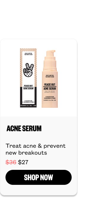 Acne Serum for $27