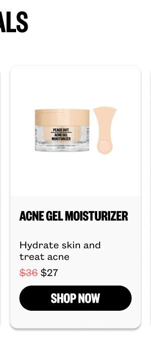 Acne Gel Moisturizer for $27
