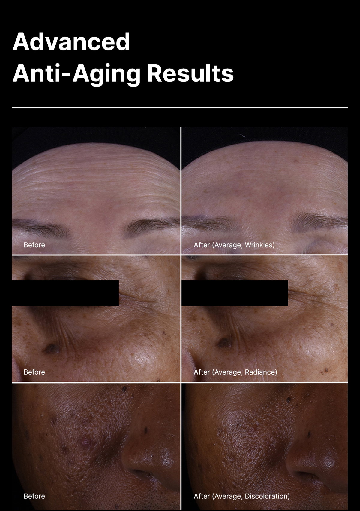 Advanced Anti-Aging Results