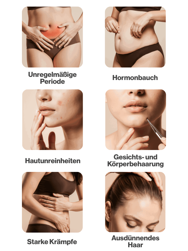 Unregelmäßige Periode, hormoneller Bauch, starke Krämpfe, Hautunreinheiten, Gesichts- und Körperbehaarung, ausdünnendes Haar