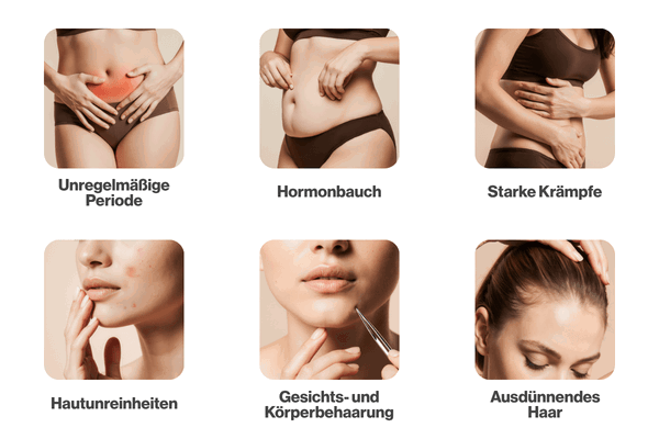 Unregelmäßige Periode, hormoneller Bauch, starke Krämpfe, Hautunreinheiten, Gesichts- und Körperbehaarung, ausdünnendes Haar