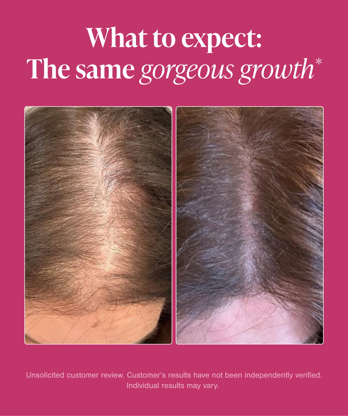 Before and after customer hair growth results image with headline ‘What to expect: The same gorgeous growth.’ Side-by-side photos show improved hair fullness and reduced visible thinning at the part line after using Viviscal Hair Growth Supplements. Includes disclaimer that results may vary and customer results have not been independently verified.