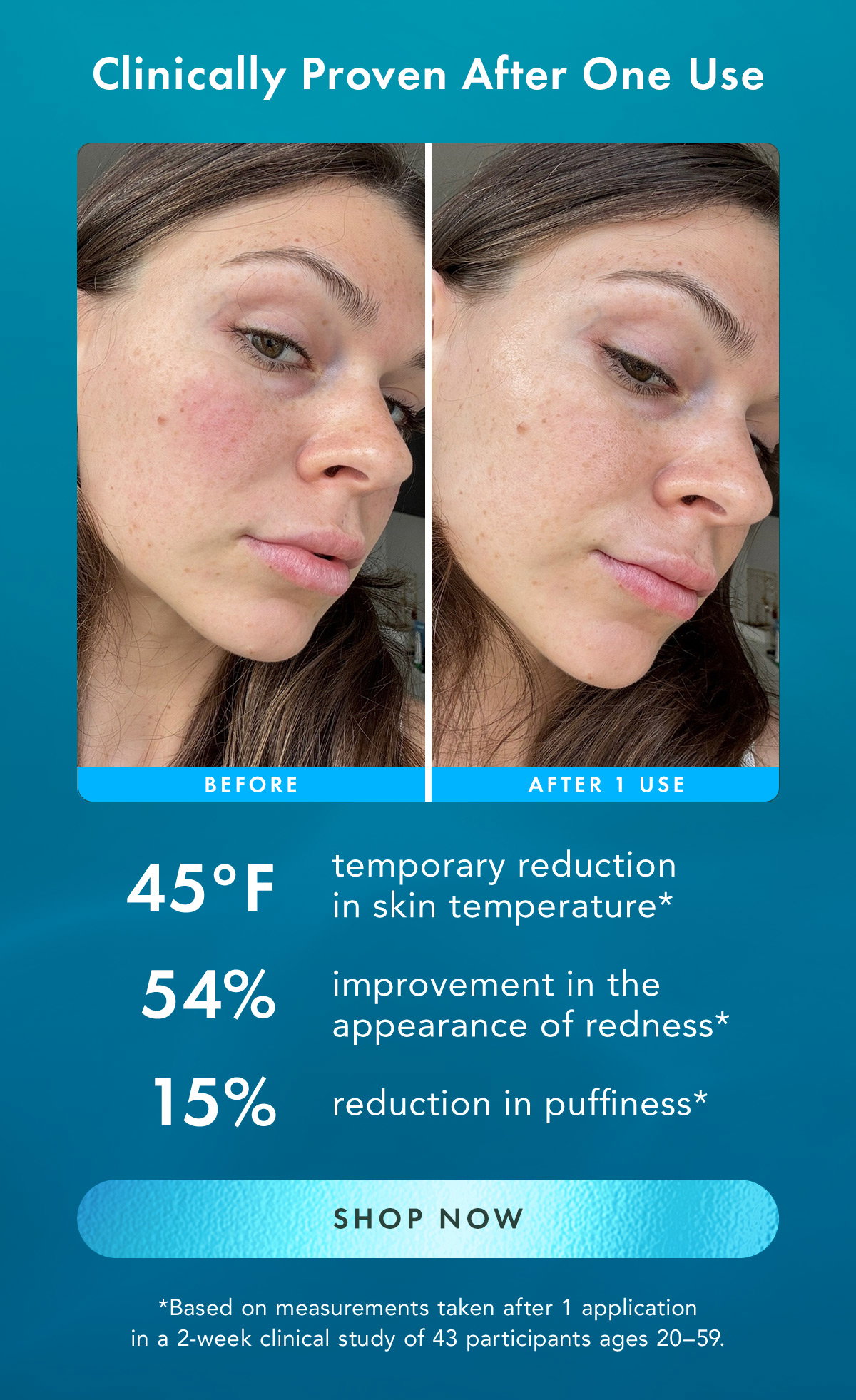 Clinically Proven After One Use. 45°F temporary reduction in skin temperature* 54% improvement in the appearance of redness* 15% reduction in puffiness* 253% boost in moisture levels*  *Based on measurements taken after one application in a 2-week clinical study of 43 participants ages 20–59. Shop Now