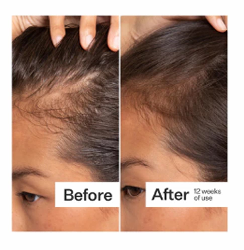 Before and After