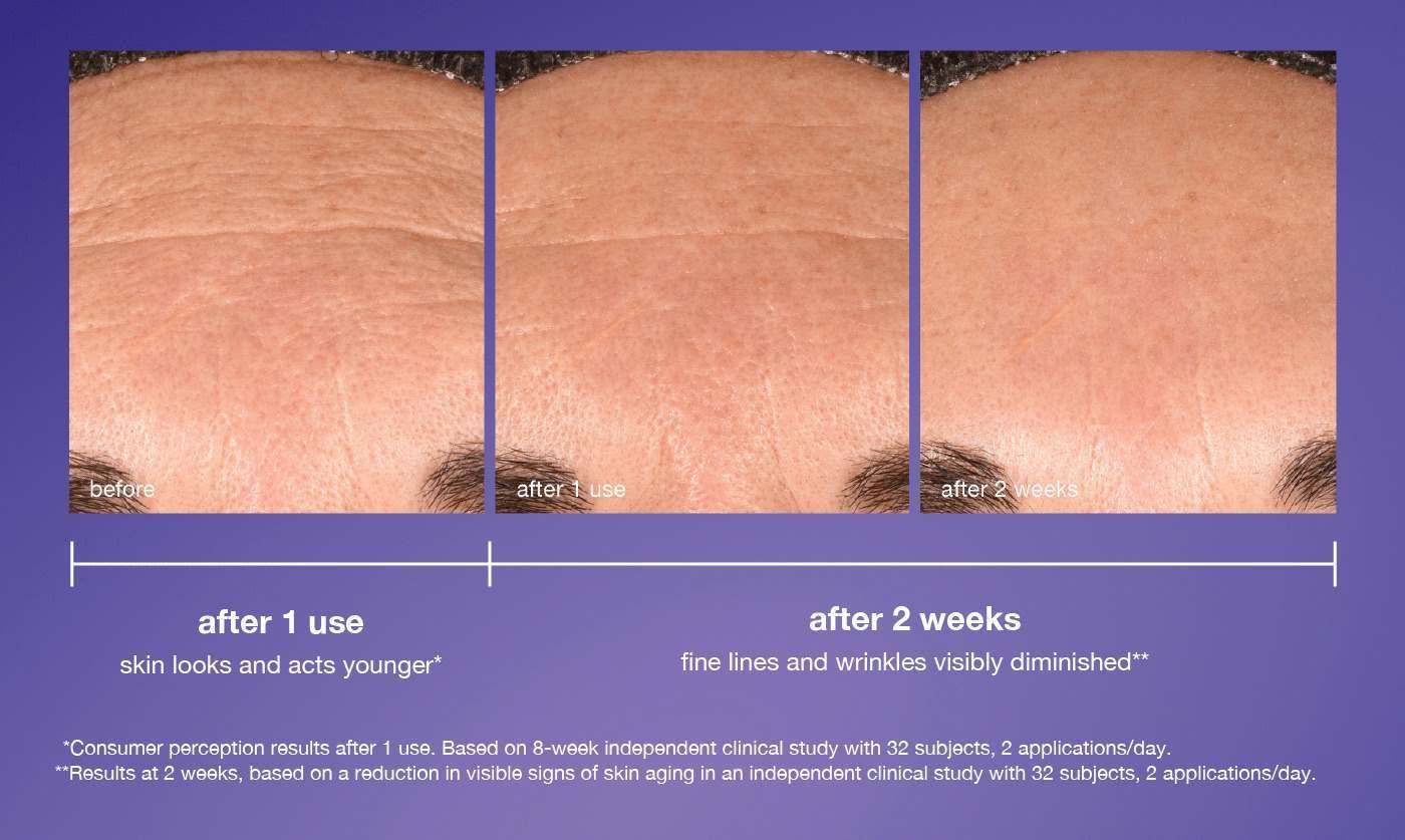 after 1 use skin looks and acts younger* | after 2 weeks fine lines and wrinkles visibly diminished** 