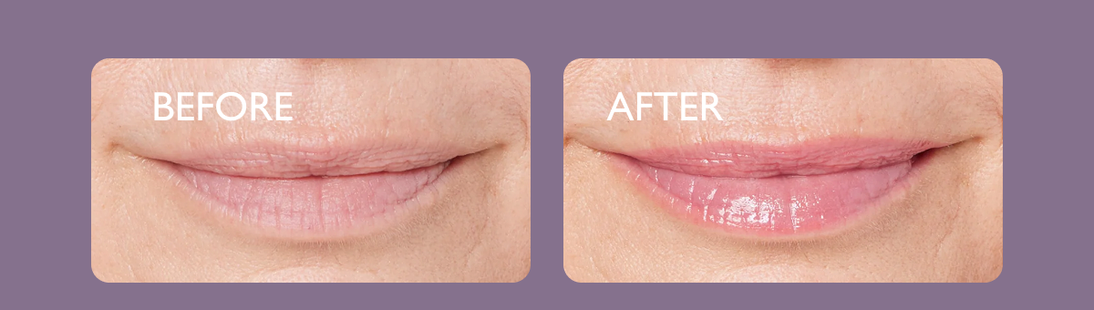 Before & After