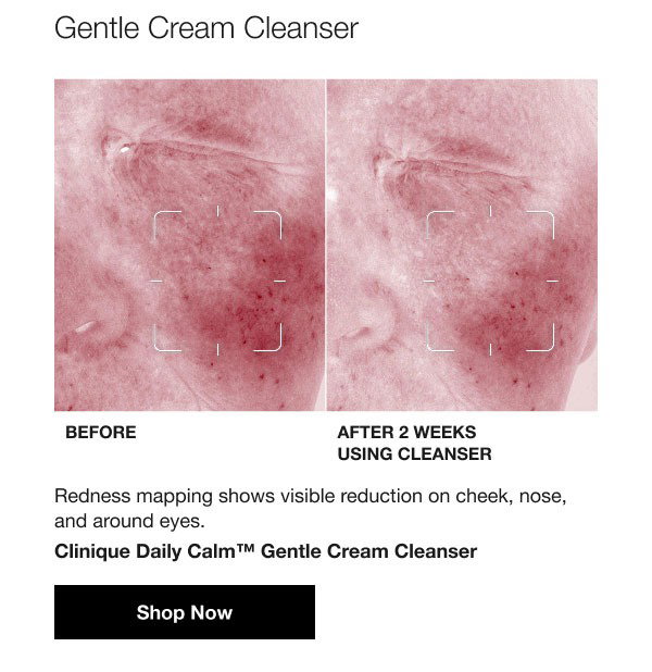 Gentle Cream Cleanser