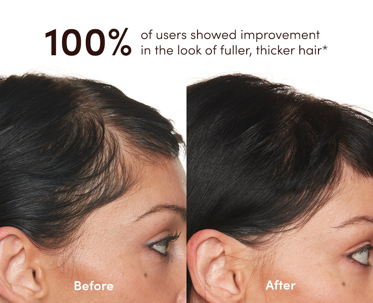 100% of users showed improvement in the look of fuller, thicker hair*