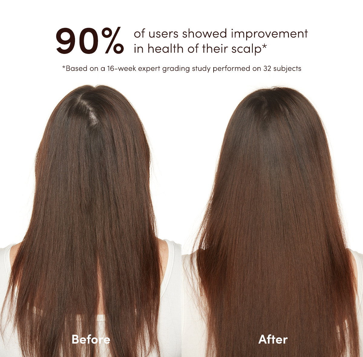 90% of users showed improvement in health of their scalp*