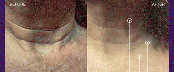 Shop 40% Off Neck Chin Jawline Sculpting Wand XL