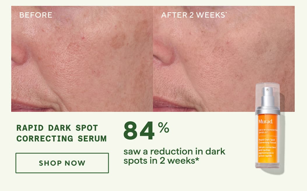 Rapid Dark Spot Correcting Serum