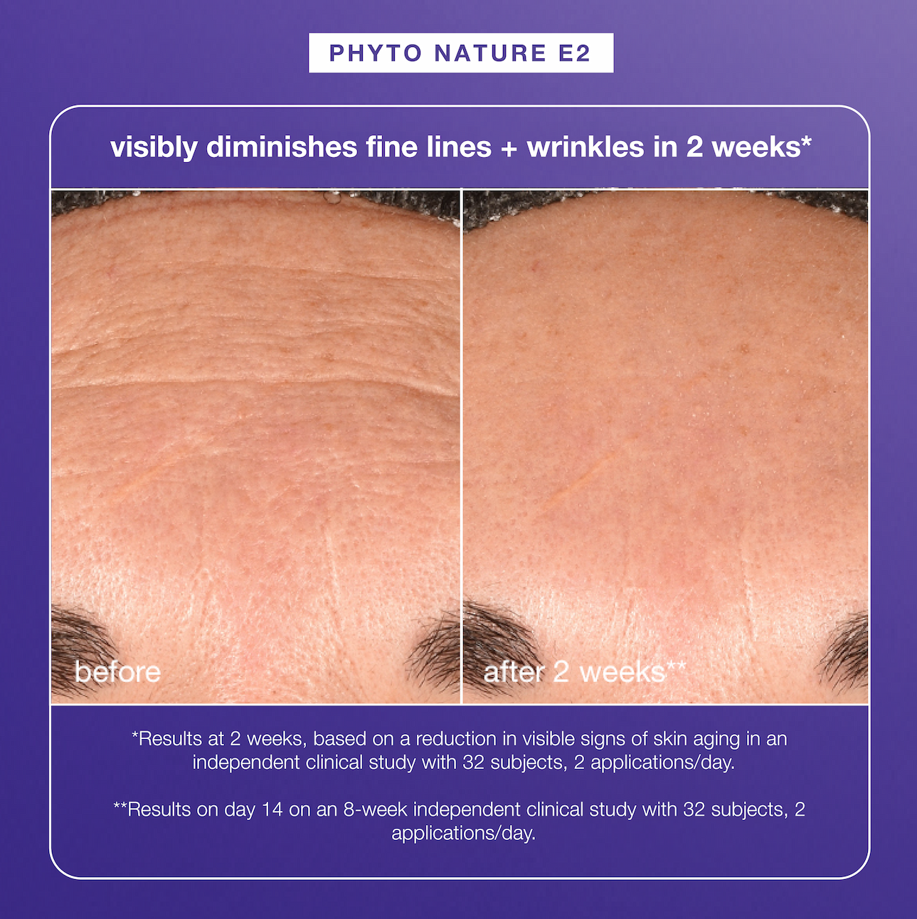 phyto nature e2​  visibly diminishes fine lines + wrinkles in 2 weeks*​  ​  *Results at 2 weeks, based on a reduction in visible signs of skin aging in an independent clinical study with 32 subjects, 2 applications/day. ​  [separate disclaimer for B&A] **Results on day 14 on an 8-week independent clinical study with 32 subjects, 2 applications/day. 