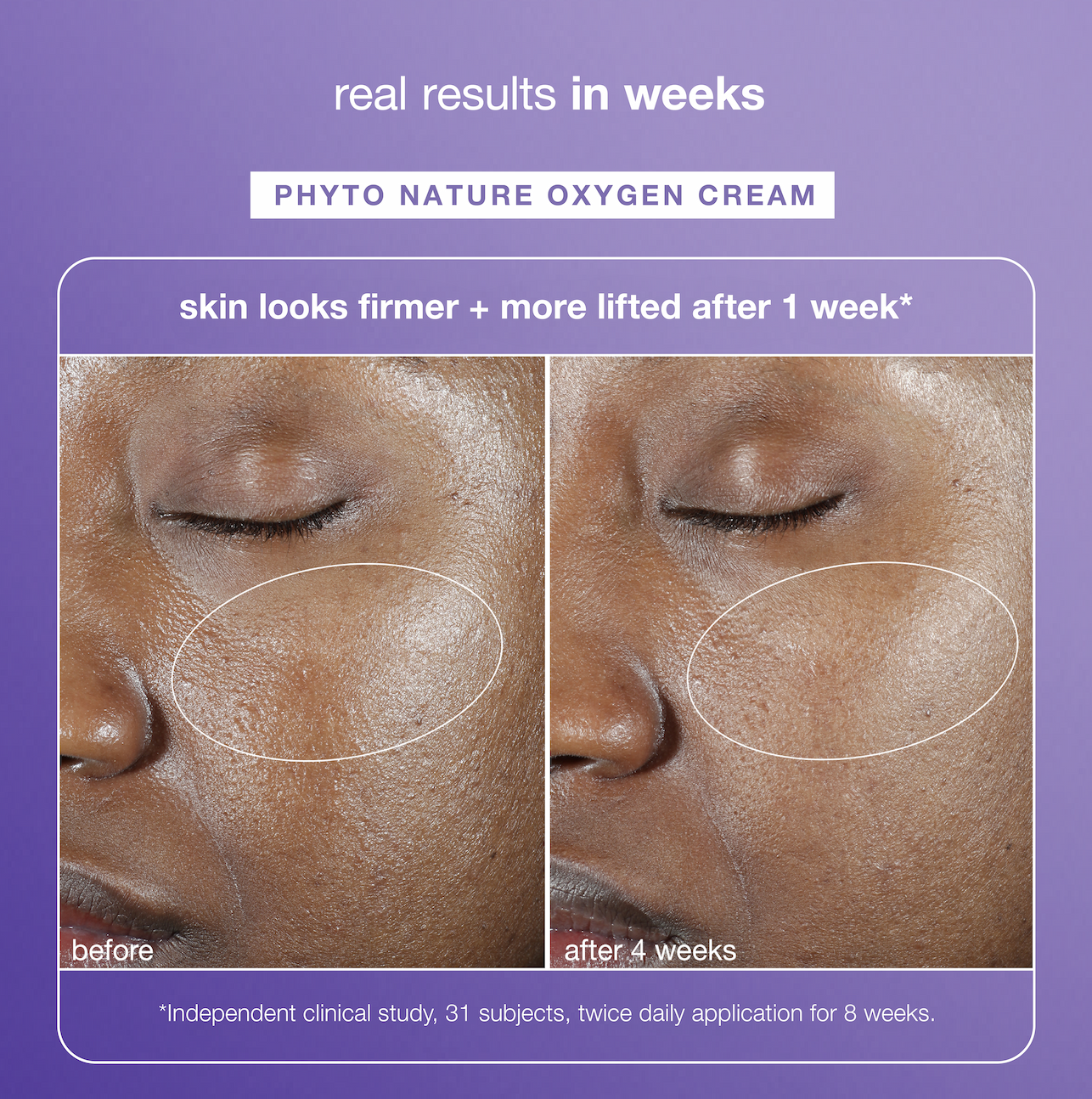 real results in weeks | phyto nature oxygen cream | skin looks firmer + more lifted after 1 week* | before | after | **Independent clinical study, 31 subjects, twice daily application for 8 weeks. 
