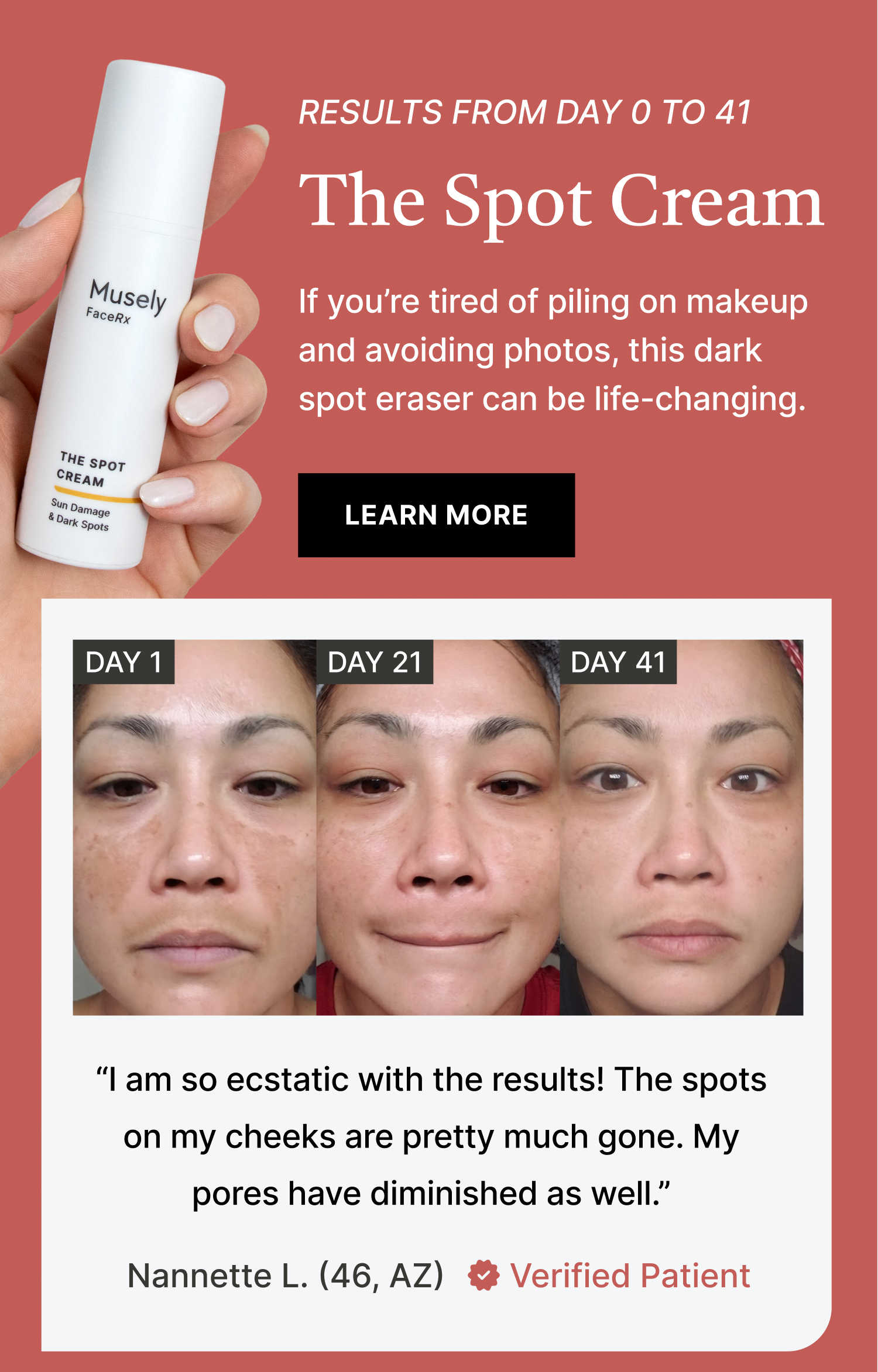 The Spot Cream: If you're tired of piling on makeup and avoiding photos, this dark spot eraser can be life-changing.