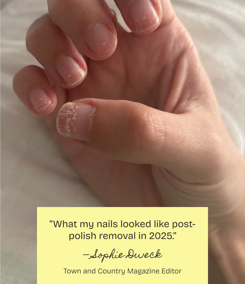 What my nails looked like post-polish removal in 2025.