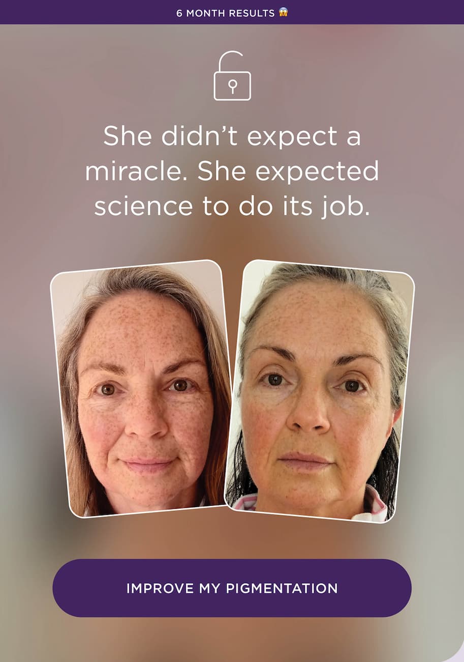 Pigmentation