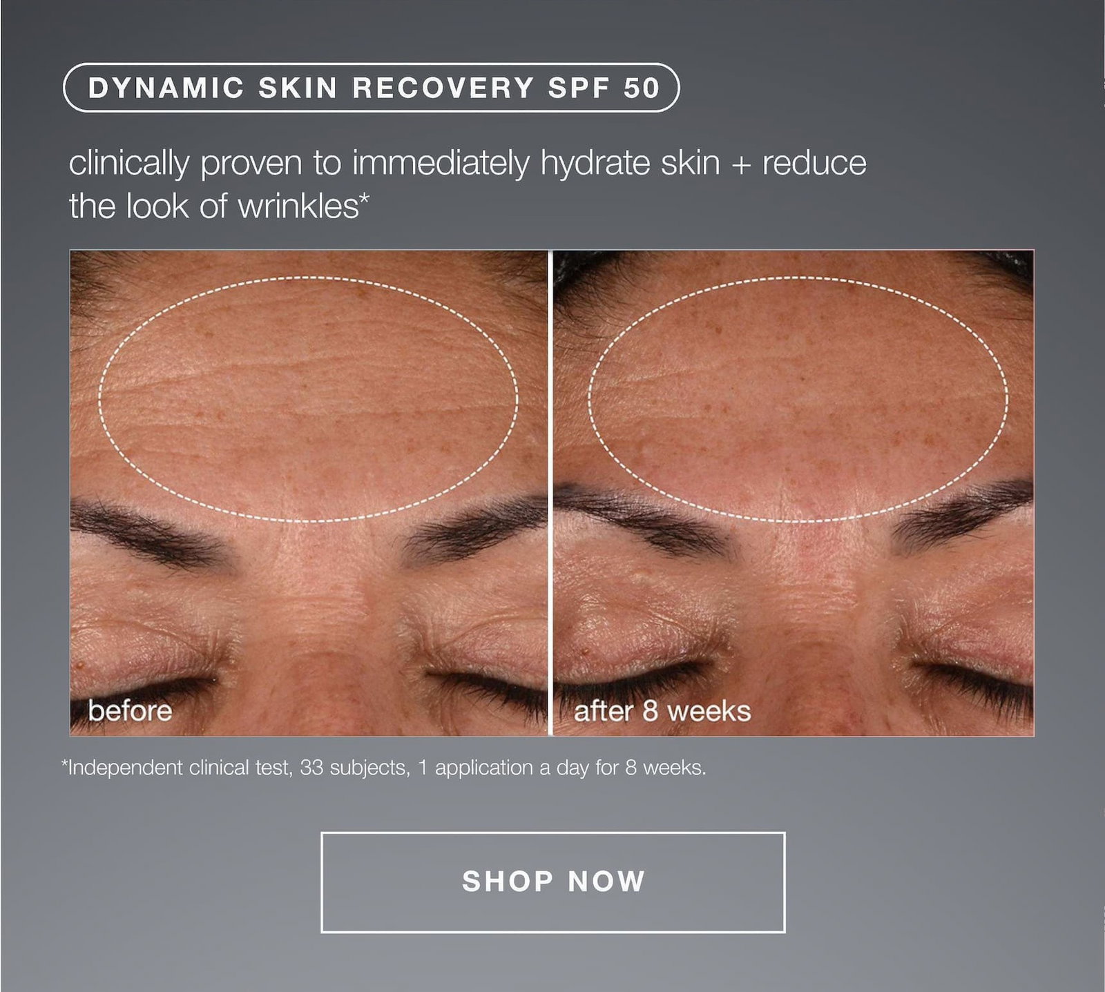 dynamic skin recovery spf 50 ​  clincally proven to immediately hydrate skin + reduce the look of wrinkles* | *independent clinical test, 33 subjects, 1 application a day for 8 weeks | SHOP NOW