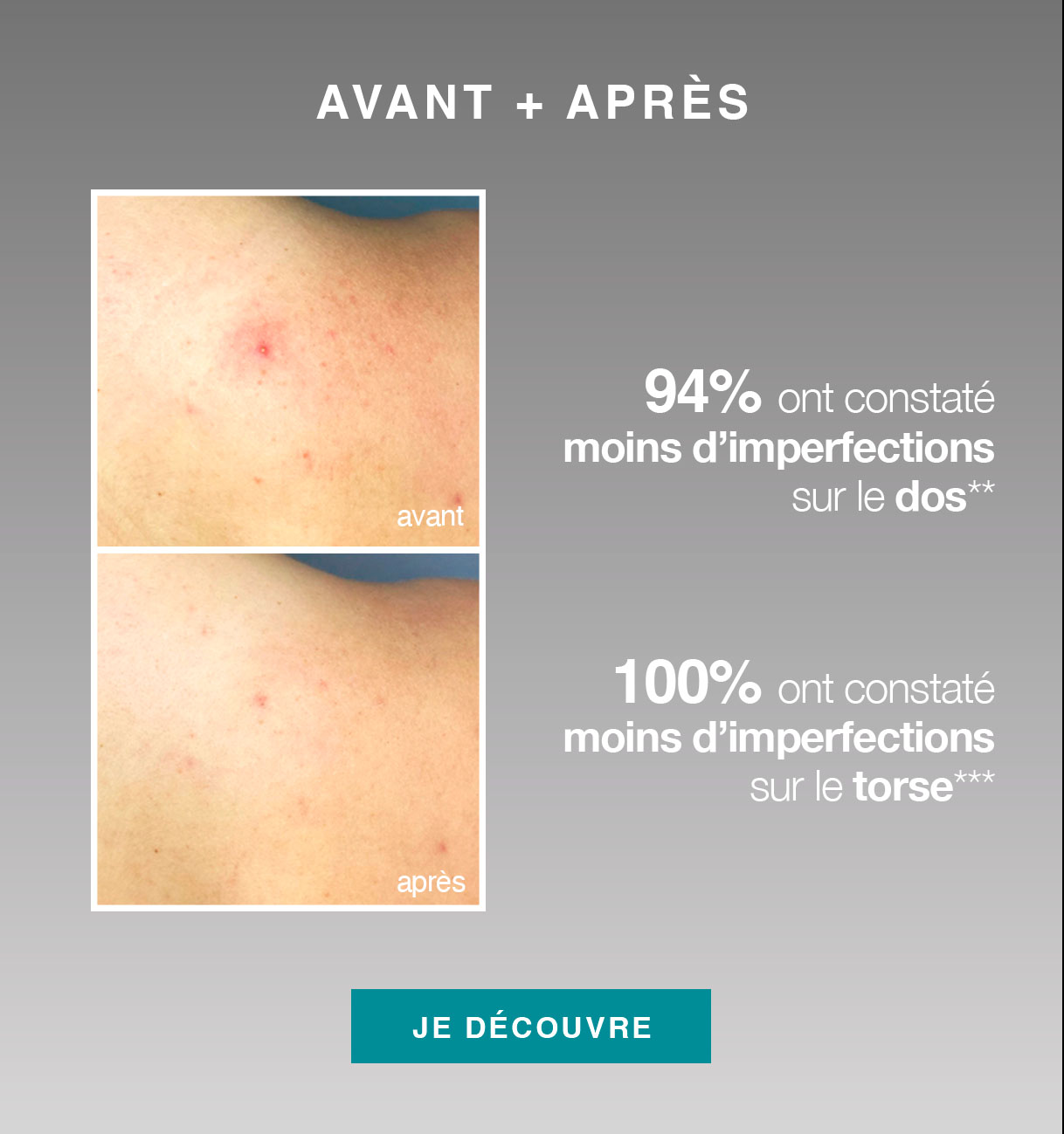 Avant et Après